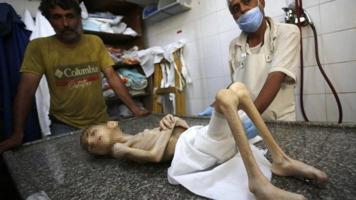 Gazze Şeridi'nde Gıda Krizi ve Yetersiz Beslenme Alarm Veriyor